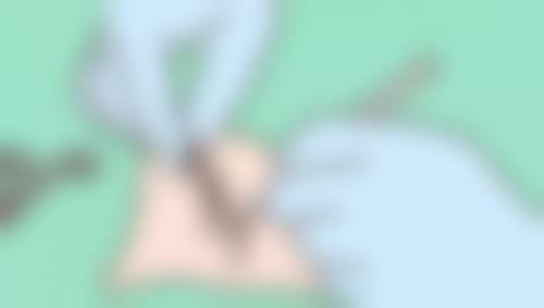 库尔勒奥蕊斯整形医院口碑评价怎么样？