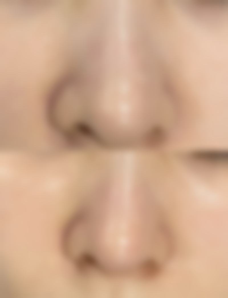 泉州万喜医疗美容门诊部陈石海医生患者评价