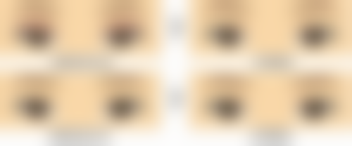 耳软骨隆鼻的成效如何？