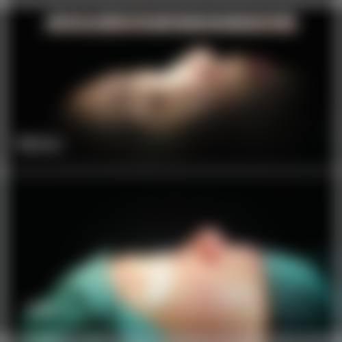 上海华澳整形美容医疗中 心邱梦玲医生鼻部综合整形技术怎么样？