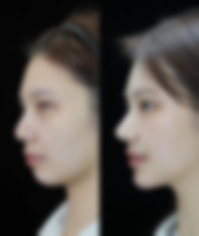 新余美天美整形医院正规吗？