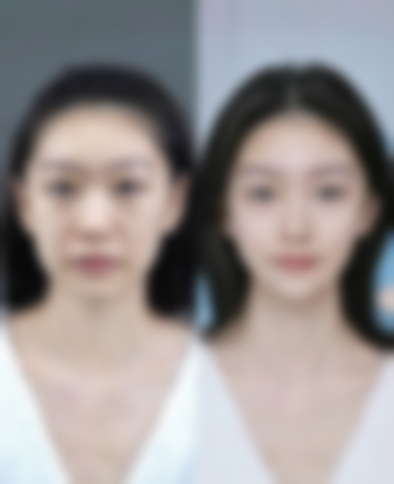 温州佳人汇（原蒂美）医疗美容诊所收费价格表