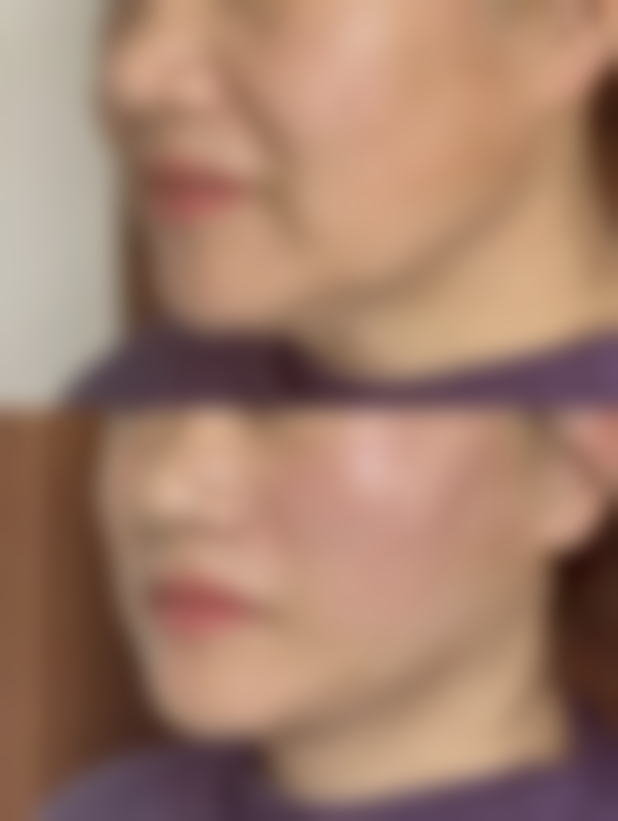 保定市第二医院医疗美容科怎么预约