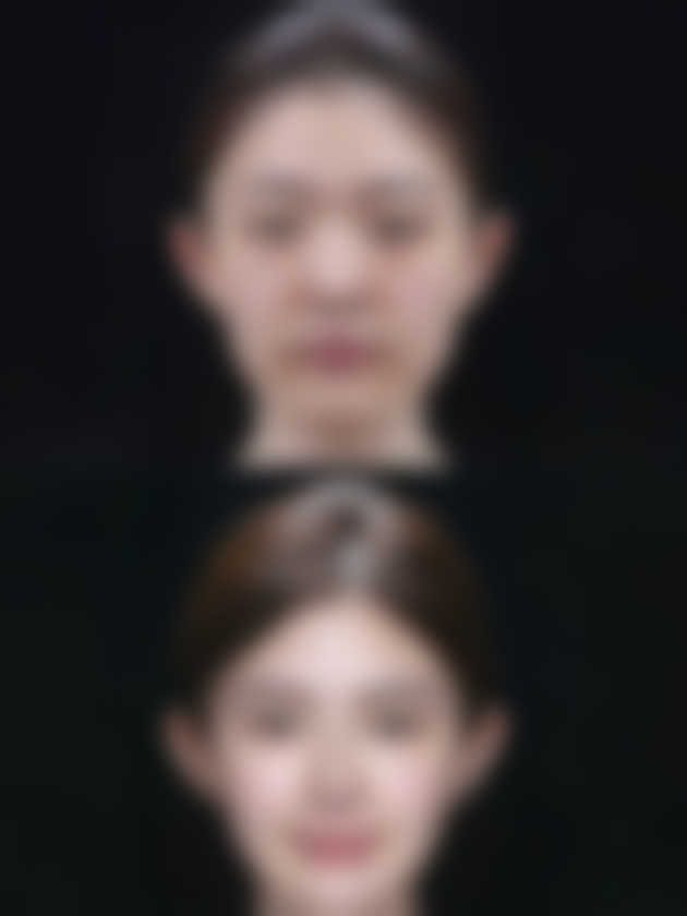 抽脂对身体有害吗女性？正确操作下风险可控，合理抽脂能助塑美好身材！ 