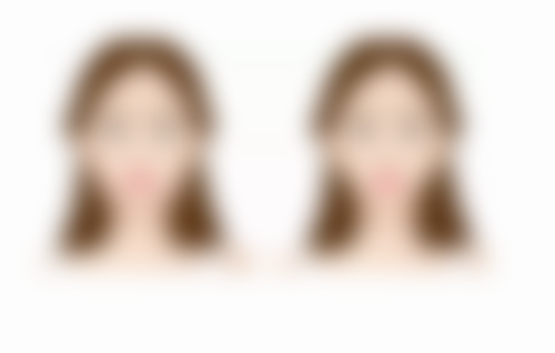 韩国MOAMAN毛阿满医院尹岗烋医生预约挂号指南