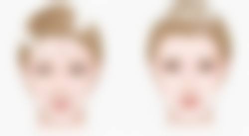 深圳市东芳韵美整形医疗门诊部口碑评价怎么样？