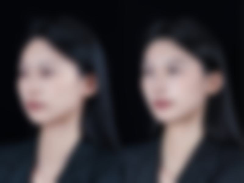 双眼皮肿眼泡怎么自己改善？试试按摩、冰敷和合理作息，效果看得见！ 