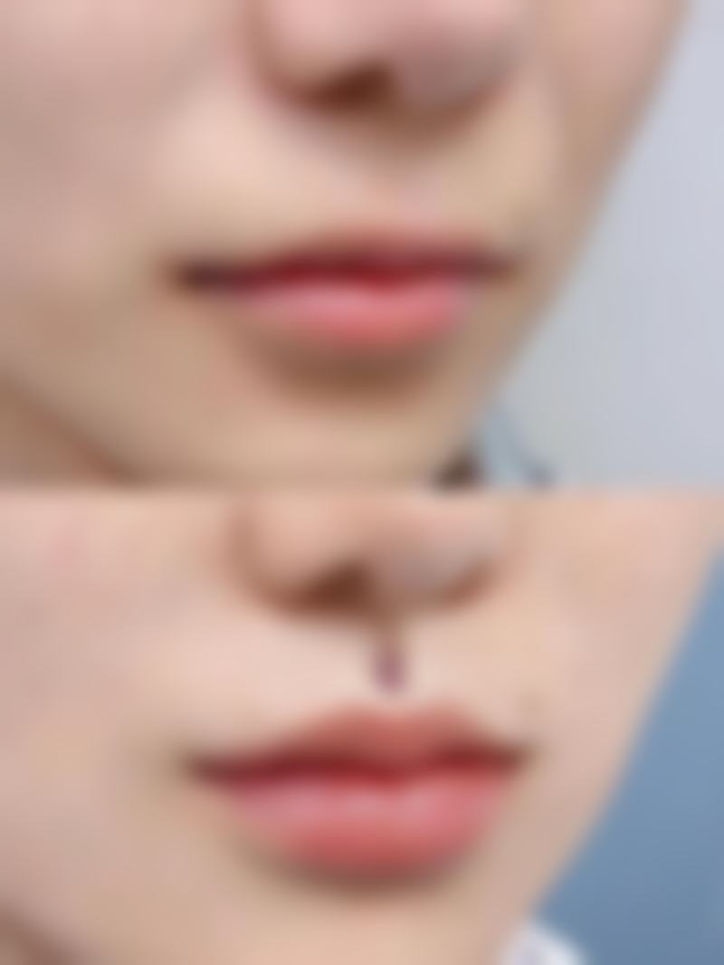 无锡虹桥医院私密俞真花医生收费价格