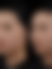 杭州善慈整形医疗美容医院怎么预约