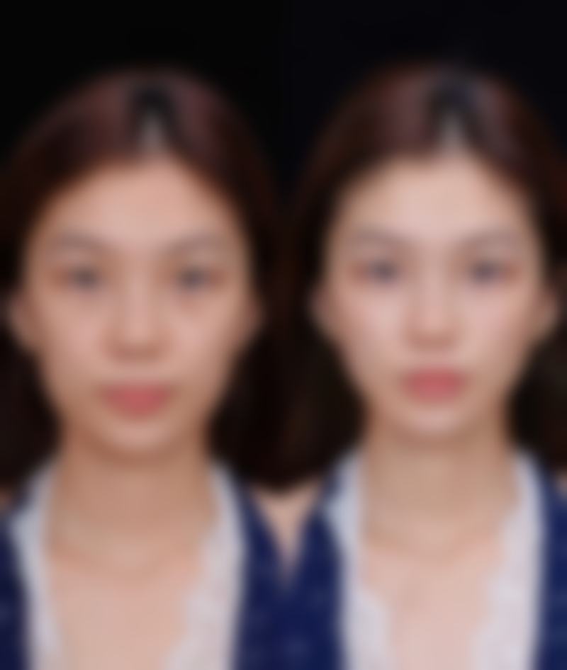 台中雅美姬時尚診所口碑评价怎么样？