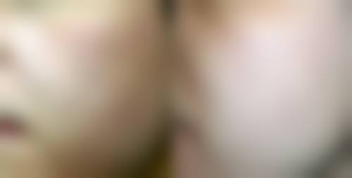 咬肌厚度对瘦脸针剂量有什么影响?