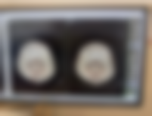 北京聚美汇成整形医疗美容门诊部口碑评价怎么样？