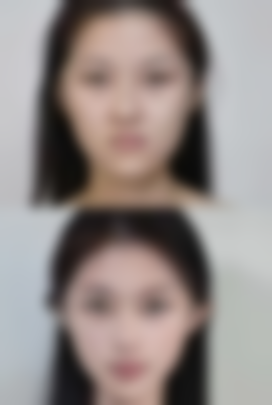 北京聚美汇成整形医疗美容门诊部正规吗？