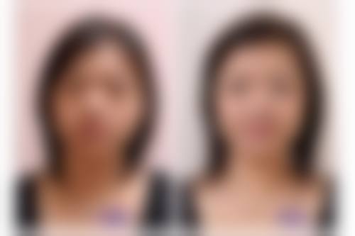 日常护理还有哪些要点能帮助消肿？