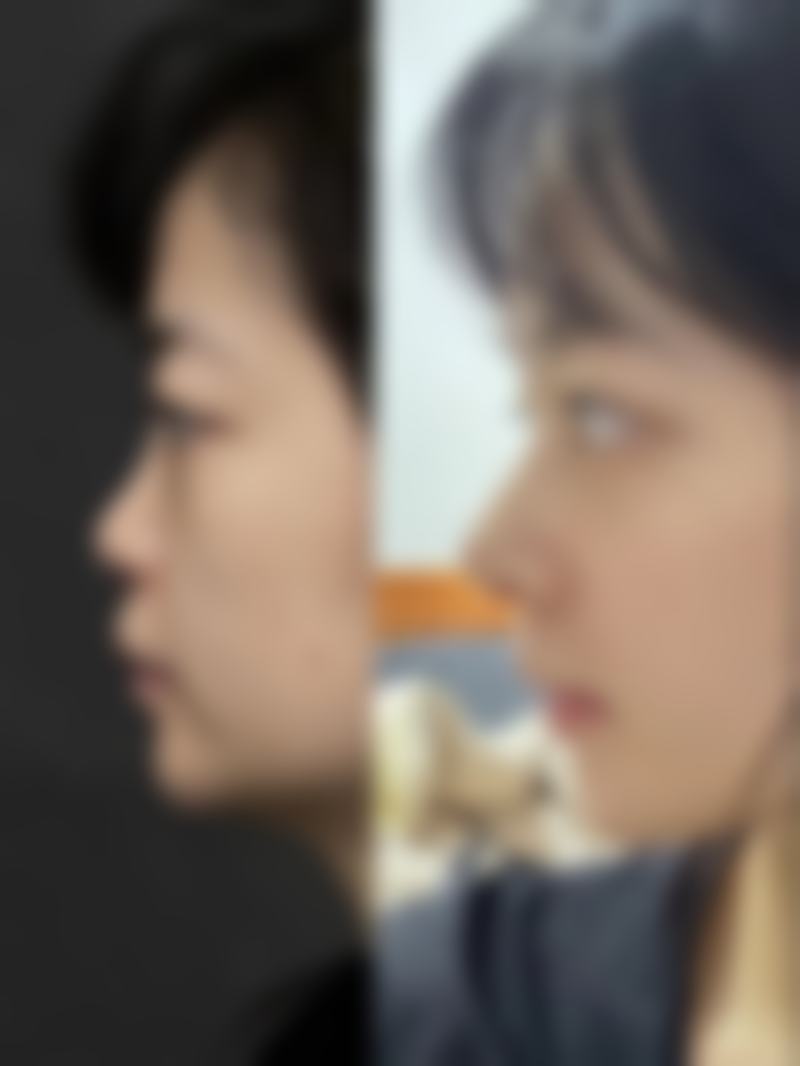 广安美媛芳龄整形医院怎么预约