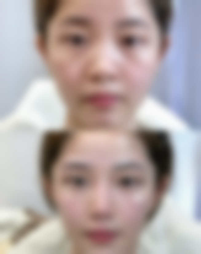 日常生活中如何预防和保养，避免眼袋产生？