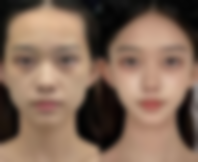 PS处理黑眼圈和眼袋有哪些通用自然美学原则呢？