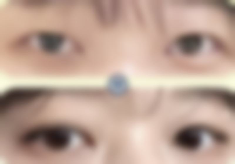 邵阳兰积恒源美整形医院正规吗？