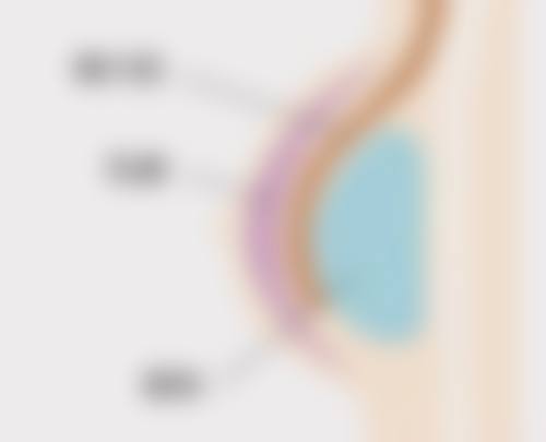 疤痕出现哪些情况需要及时就医？