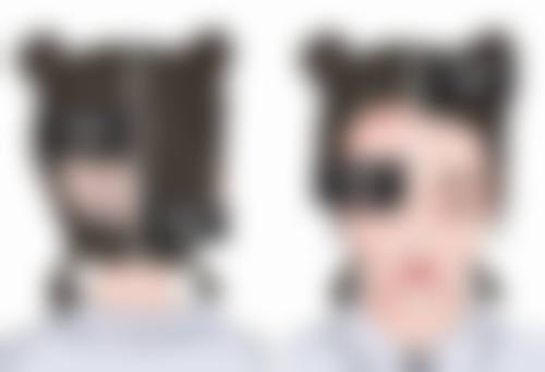 松原铭医海峡整形医院杨晓光医生隆鼻技术怎么样？