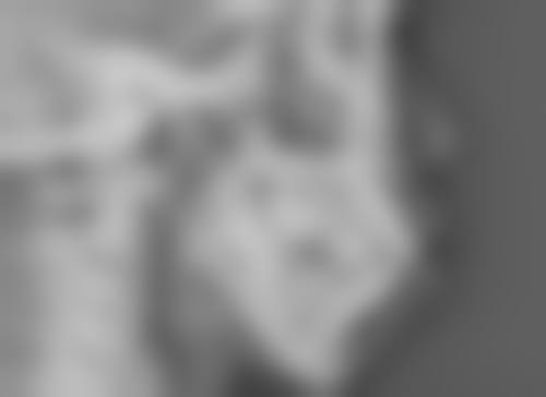 双眼皮术后在去美容院洗脸前有哪些通用的护理注意事项呢？