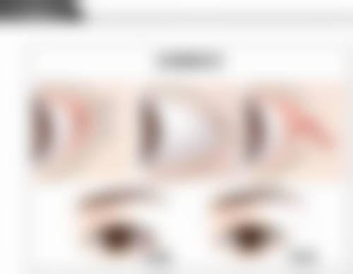 治疗疤痕的方案是怎么制定的？