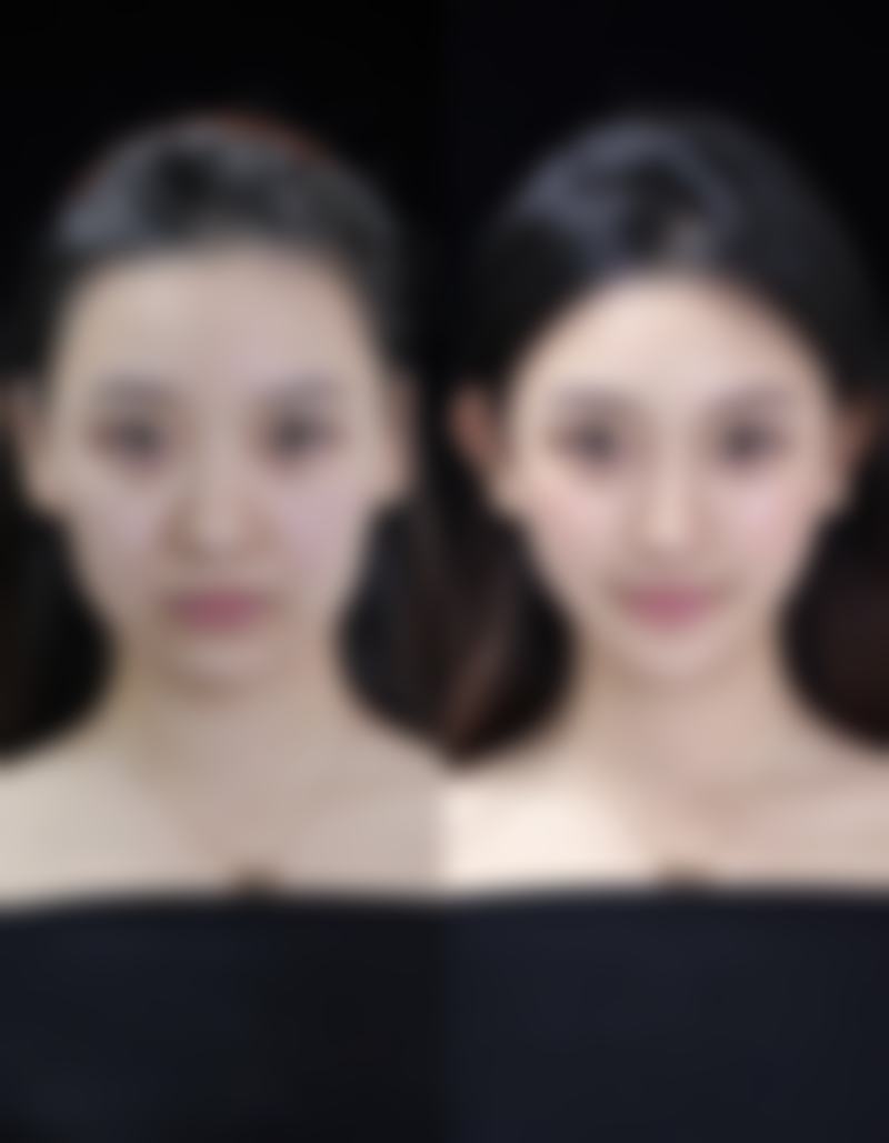 白山汉诚整形医院王殿峰医生擅长项目