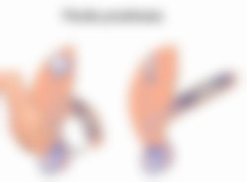 压力疗法祛疤是怎样进行的?