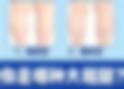 哪些人不适合做肚子吸脂呢？