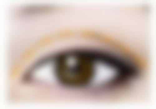 激光治疗对粉刺留下的疤痕有成效吗?