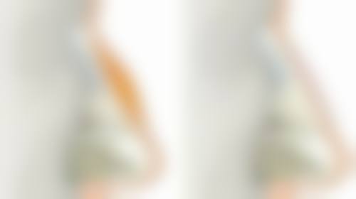 粉刺留下的疤痕能完全去除吗?