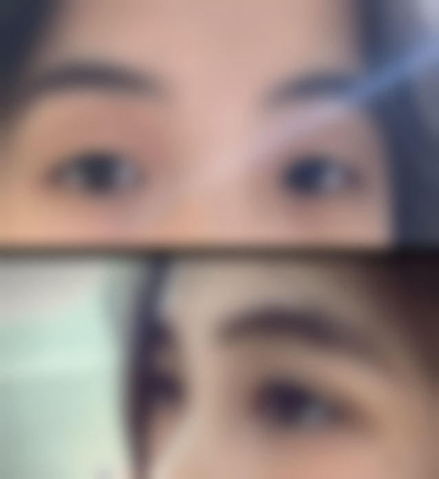 盐城圣吉美整形医院口碑评价怎么样？