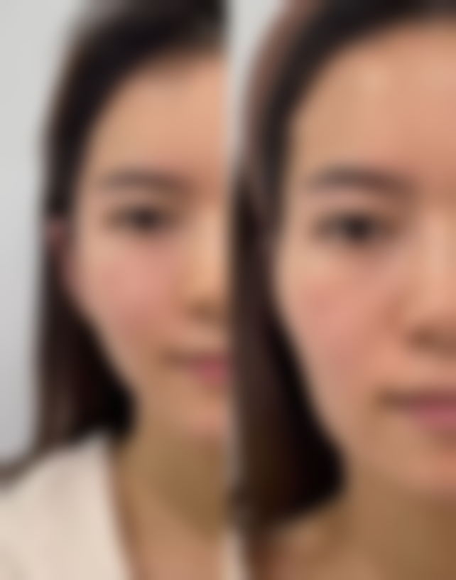 北京大学国内外医院整形美容科陈织医生擅长项目