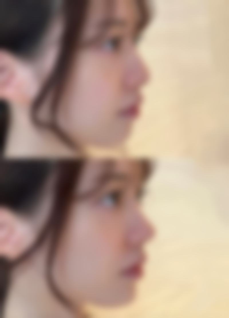 如果外用药物成效不佳该怎么办呢？