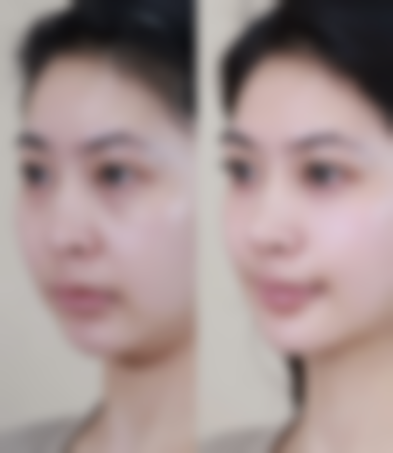 韩国SY整形外科正规吗？