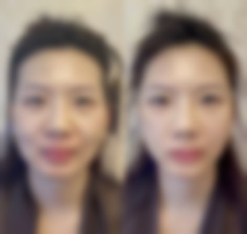 昆明幻颜美容医院怎么预约