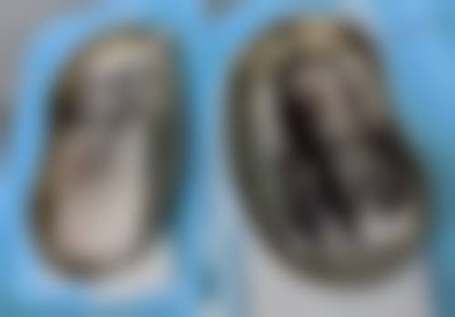 北京亚龙医疗美容医院口碑评价怎么样？