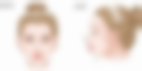 olioli祛疤膏成效如何？