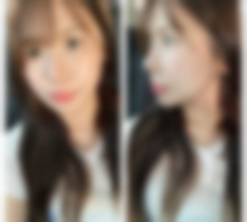 瑞安优美医疗美容门诊部口碑评价怎么样？