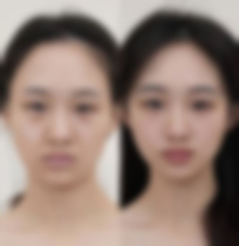 韩国美贪整形医院正规吗？