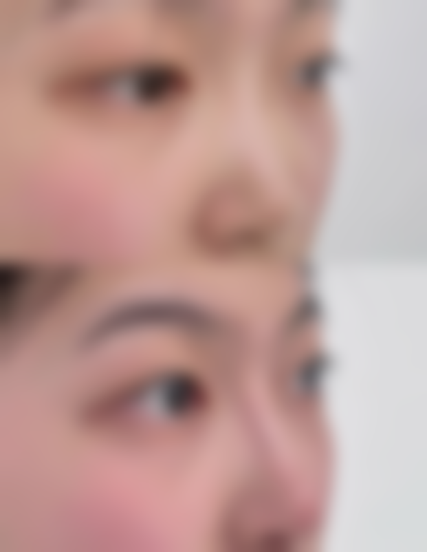 佛山瓷美颜整形医院正规吗？