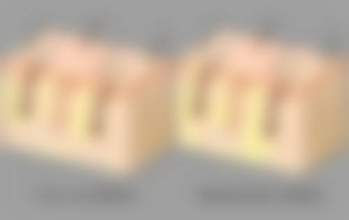 割双眼皮多久可以减肥？一般术后1 - 3个月身体恢复良好时，就可适度开启减肥计划 