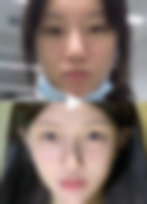 武汉米格整形医院正规吗？