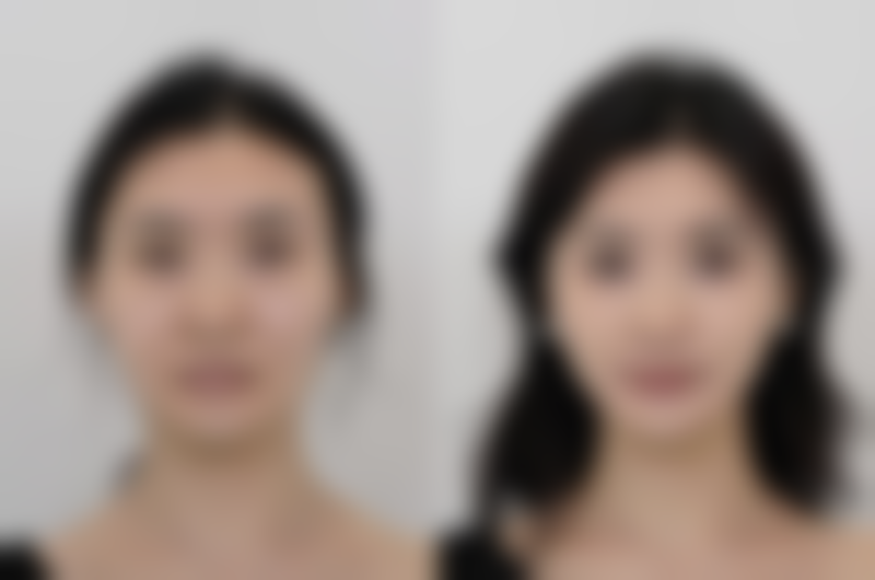 楚雄吴氏嘉美医疗美容正规吗？