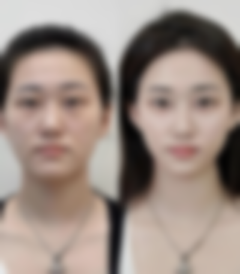 聊城美莱雅医疗美容诊所正规吗？