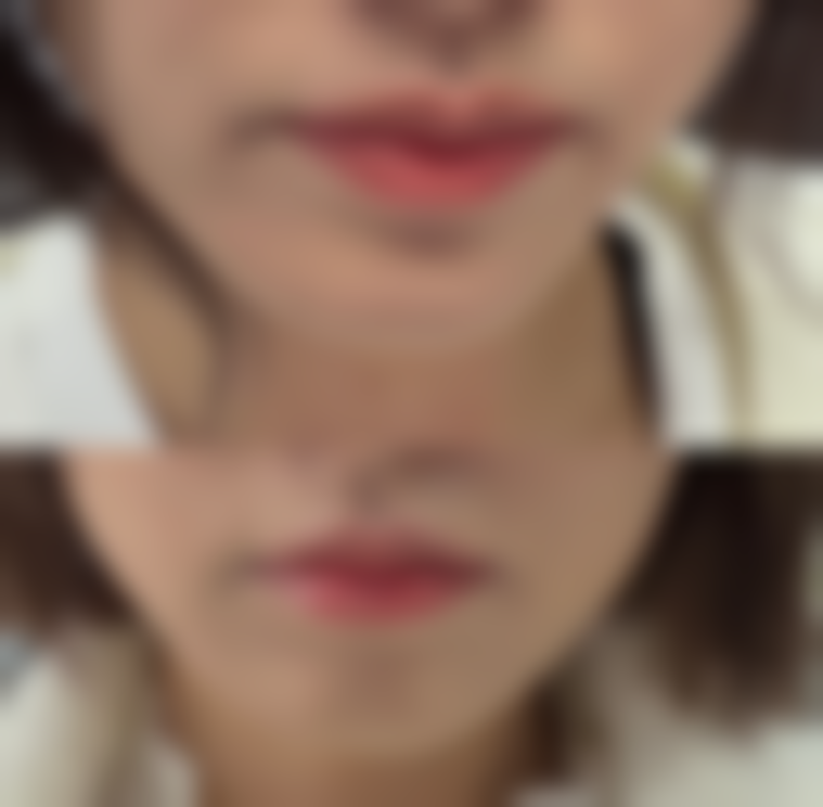 宁波鄞州花历整形医院口碑评价怎么样？