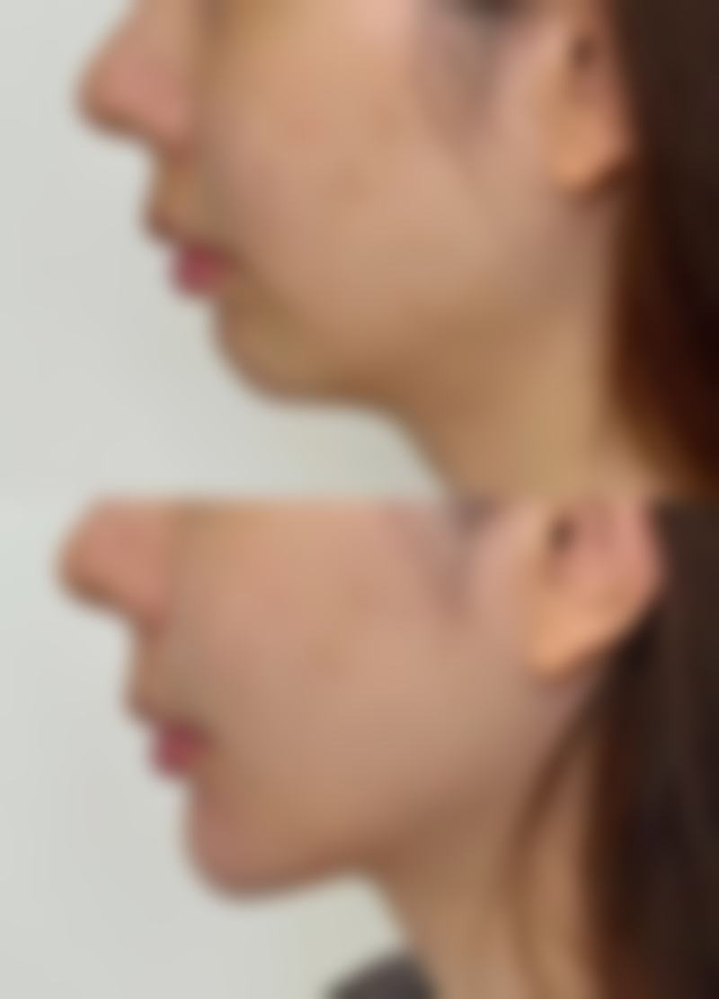 北京柠悦医疗美容诊所正规吗？