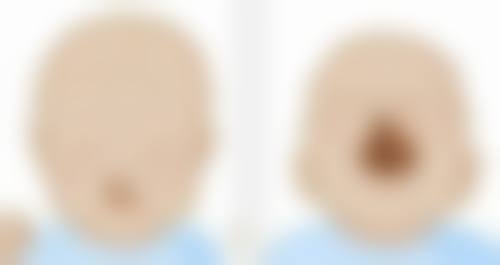 郑州美泊医疗美容门诊部姚宏伟医生患者评价