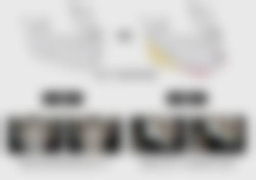 上海郑逸冰医疗美容医院郑宇哲医生隆鼻技术怎么样？