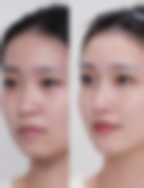 淄博德美医疗美容口碑评价怎么样？